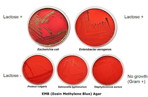 emb agar results|serratia marcescens emb agar results.